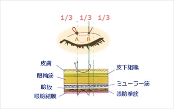 コムロ式があることで患者様の理想通りの施術を行うことが可能