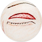 二重のライン上で余剰皮膚を切除します