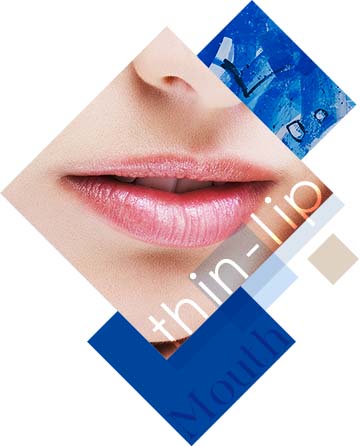 パラレルクイック